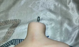 关于exdoll娃娃发霉的解决办法