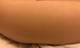 叁卉的娃娃有谁遇到类似的情况吗？