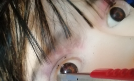 今天决定给她做个小手术