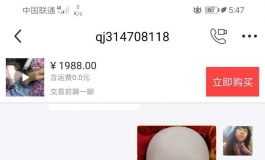 有人代做植发