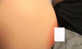 问一下，乳头颜色脱落这个属于正常现象吗