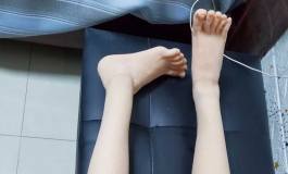 先纳信凛音骨架断了，还有救吗